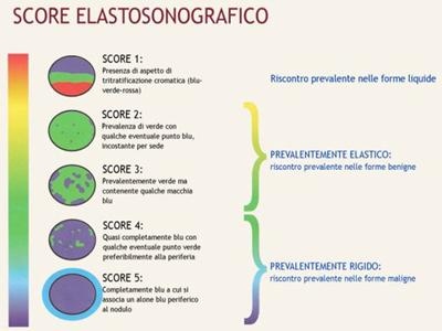 ELASTOSONOGRAFIA